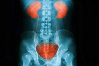 21 consejos para prevenir la infección urinaria