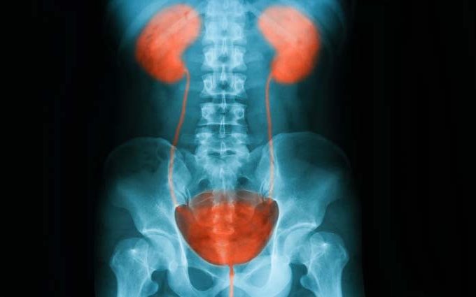 área alrededor de la uretra inflamada