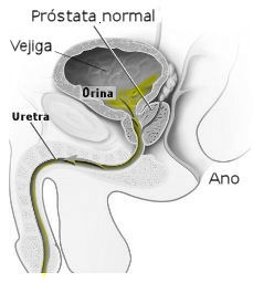 Prostata cronica bacteriana