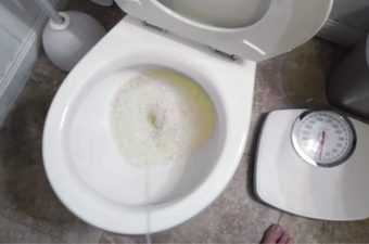 Causas de urina espumosa e proteinúria