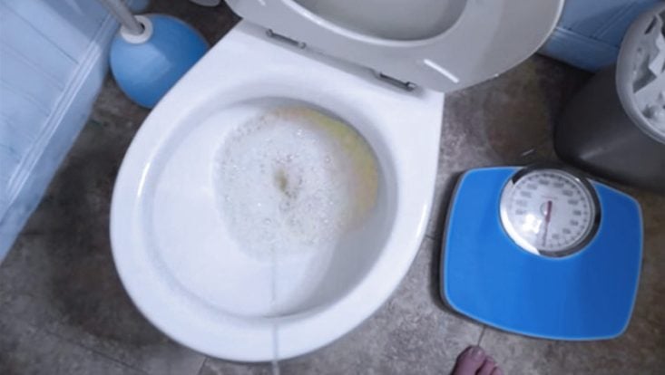 Urina espumosa