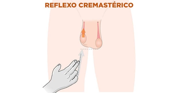 Espermatocele: o que é, sintomas, causas e tratamento - Tua Saúde