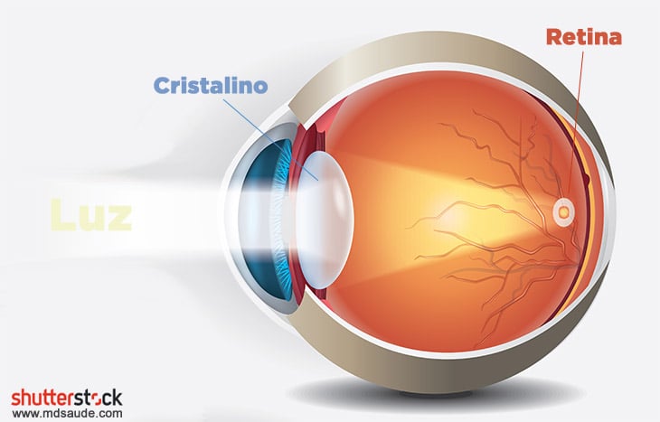 Descolamento de Retina - Instituto de Moléstias Oculares