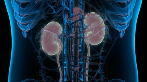 Ectopia renal