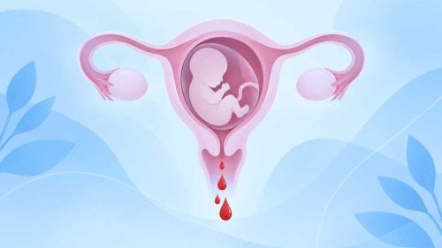 Sangramento vaginal na gravidez