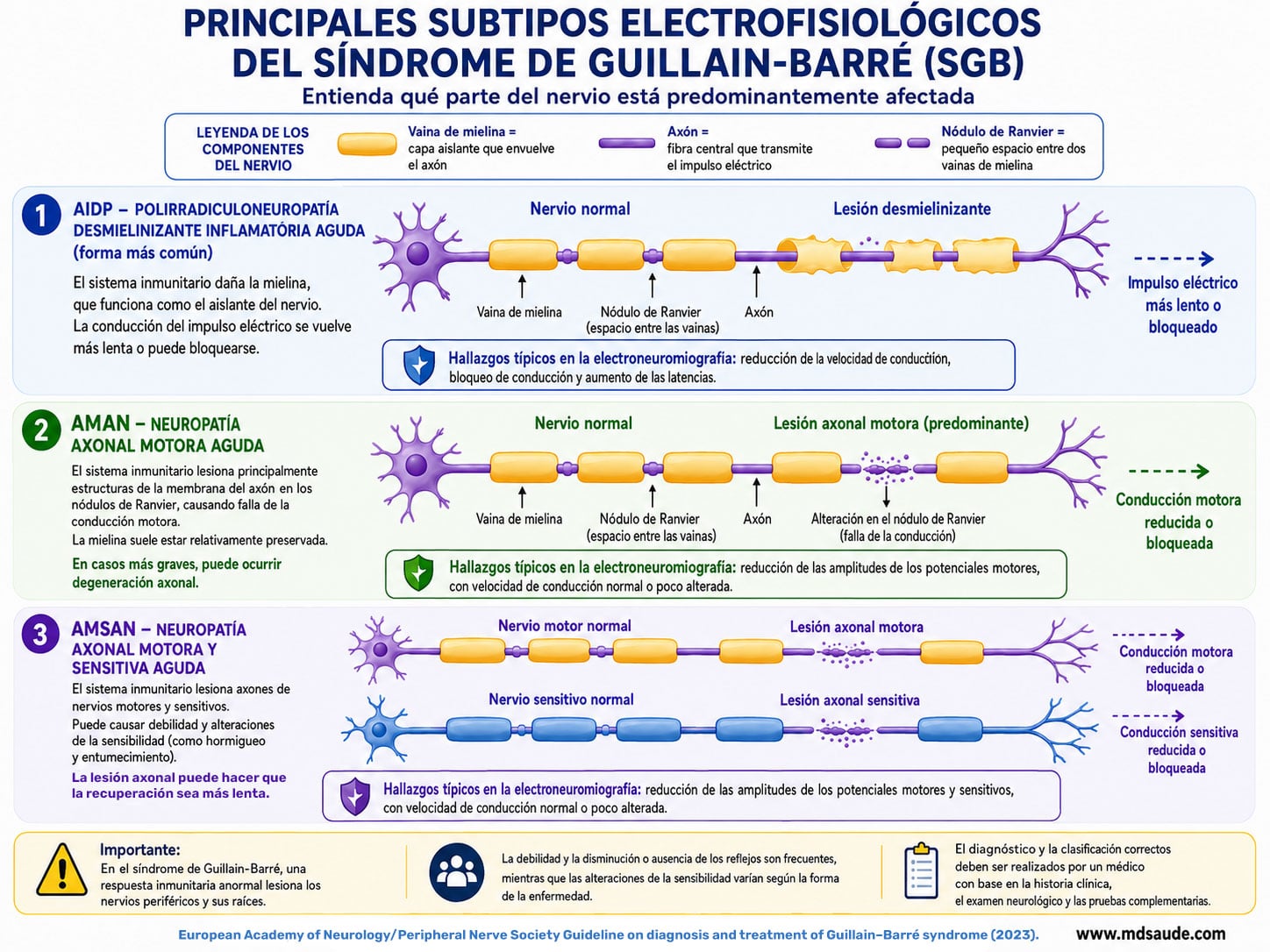Variantes del síndrome de Guillain-Barré