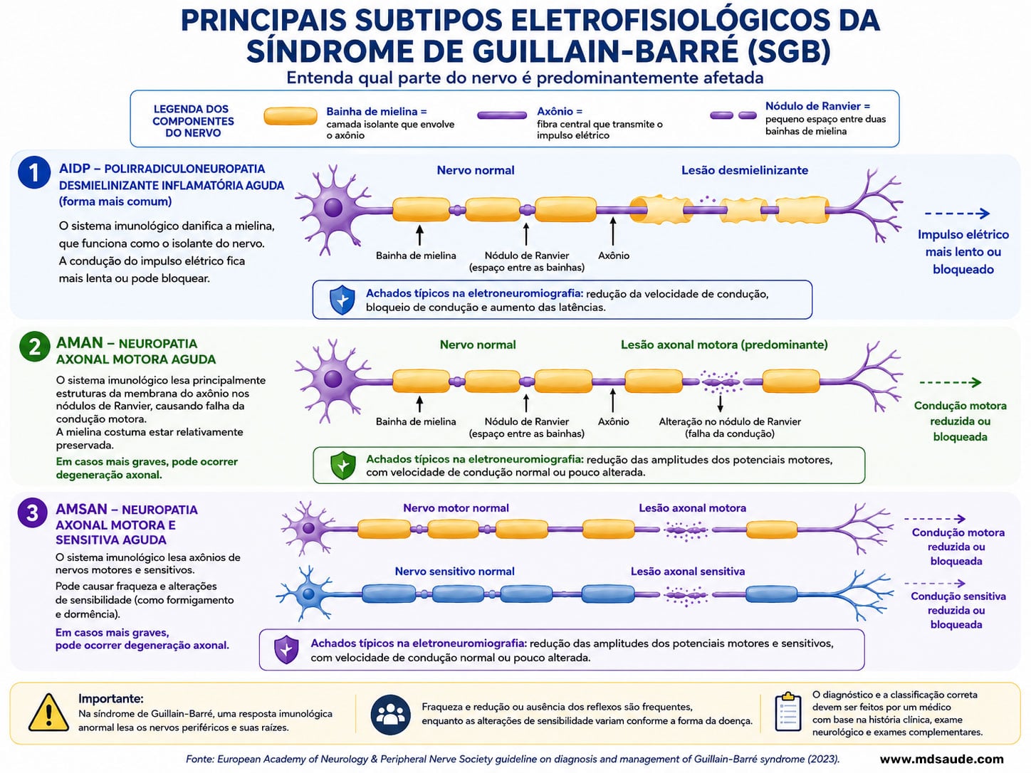 Variantes da síndrome de Guillain-Barré