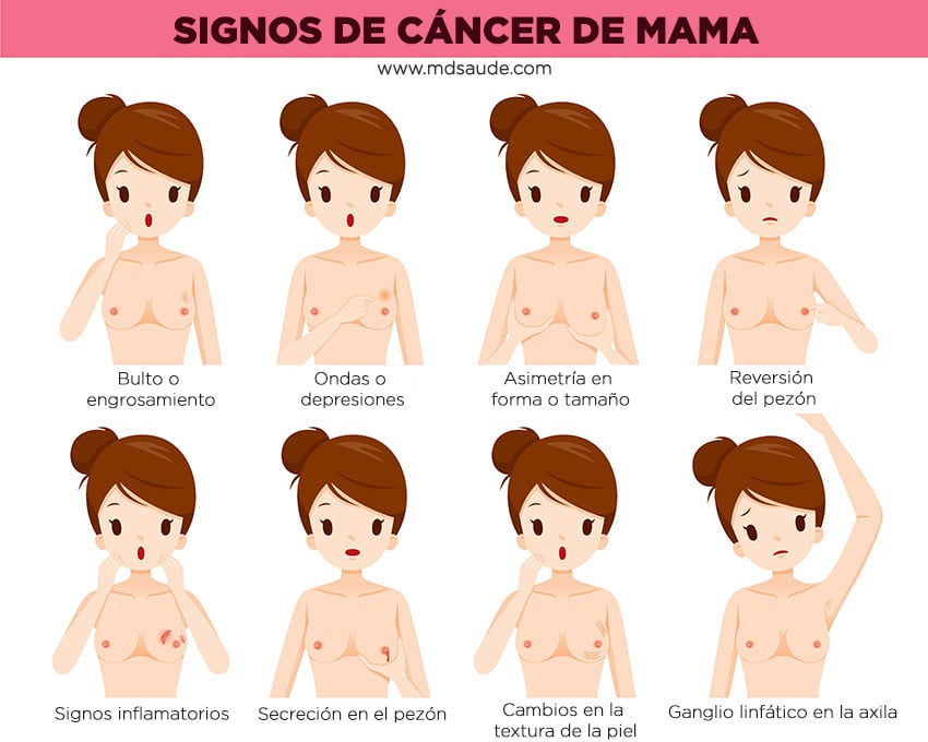 Principales signos de tumor en la mama 