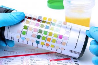 Síndrome nefrótica