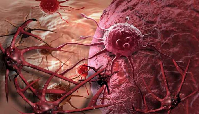sintomas-cancer-ilustracao Câncer