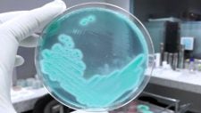 Staphylococcus aureus