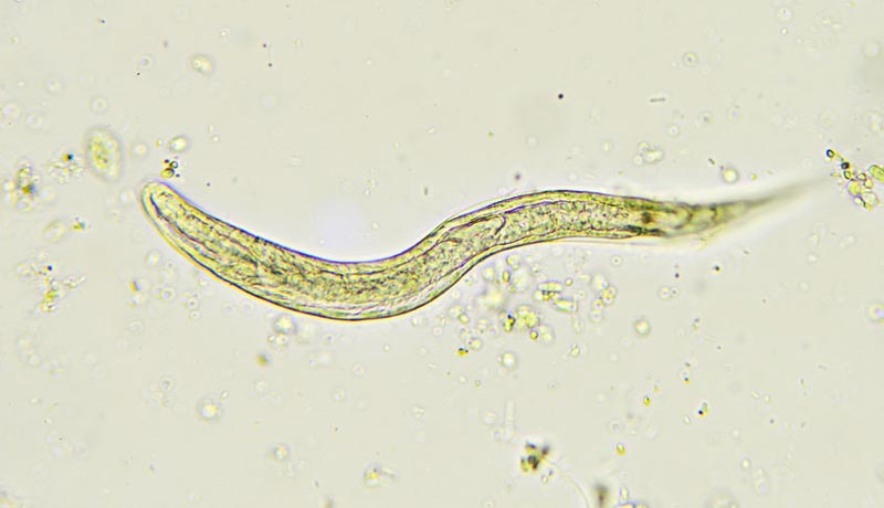 Strongyloides stercoralis