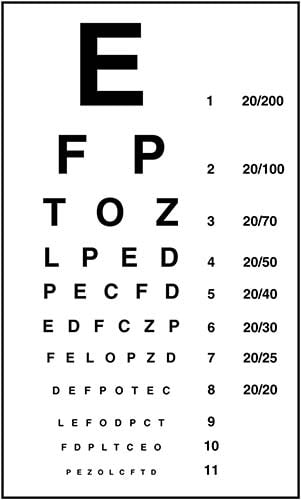 Hyperopia vagy myopia: különbségek, hasonlóságok, kezelés, megelőzés