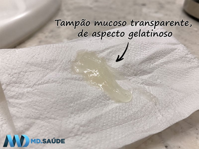 Tampão mucoso transparente, de aspecto gelatinoso, sobre papel higiênico branco.