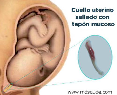 Cuello uterino sellado con tapón mucoso