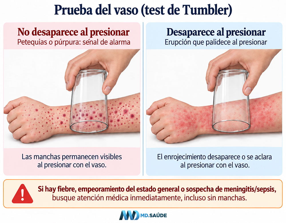 Prueba del vaso