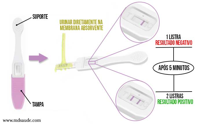 Menstruação atrasada a 12 dias, e teste de farmácia negativo