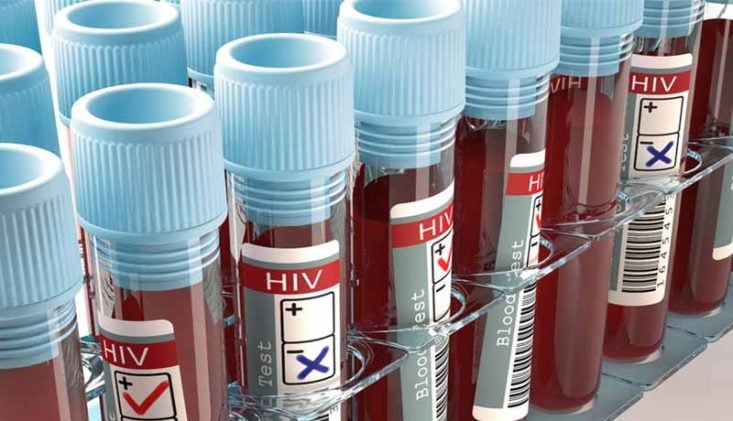 Teste HIV
