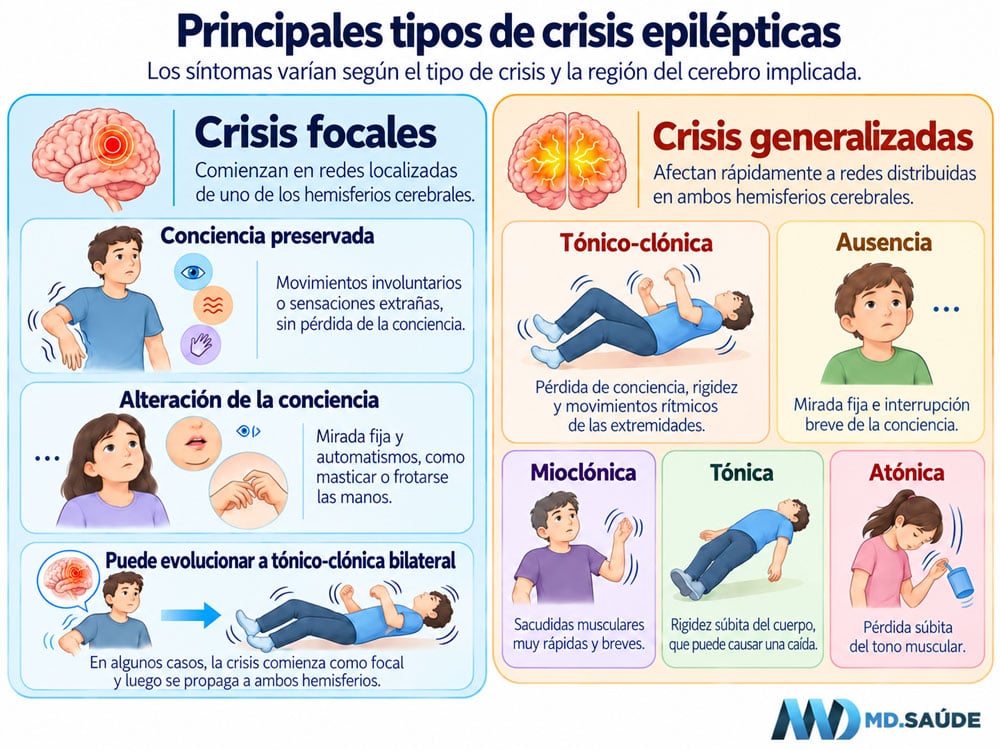 Infografía que muestra los principales tipos de crisis epilépticas, con ejemplos de crisis focales y generalizadas, incluidas las de ausencia, mioclónicas, tónicas, atónicas y tónico-clónicas.