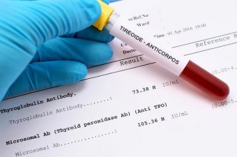 ANTICUERPOS Y TIROIDES: Anti-TPO, TRAb y Anti-tiroglobulina