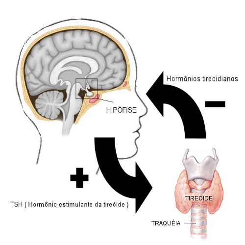 10 sinais do infarto que você provavelmente desconhece