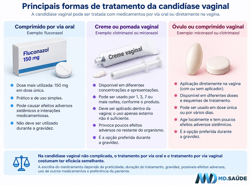 Infográfico comparando as principais formas de tratamento da candidíase vaginal: fluconazol por via oral, cremes ou pomadas vaginais e óvulos ou comprimidos vaginais.