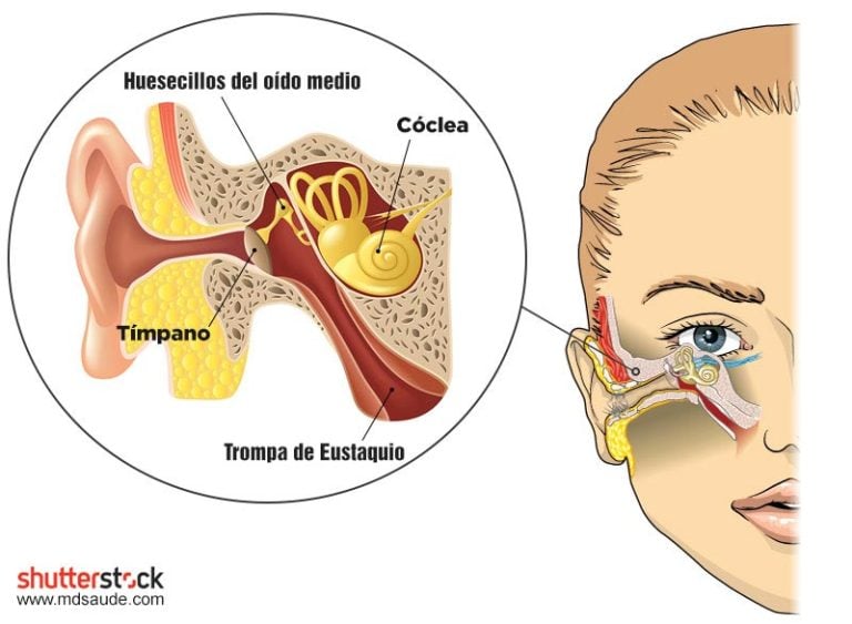 Zumbido en el oído (tinnitus): causas y tratamiento