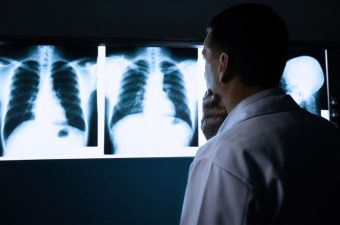 Diferenças entre pneumonia e tuberculose
