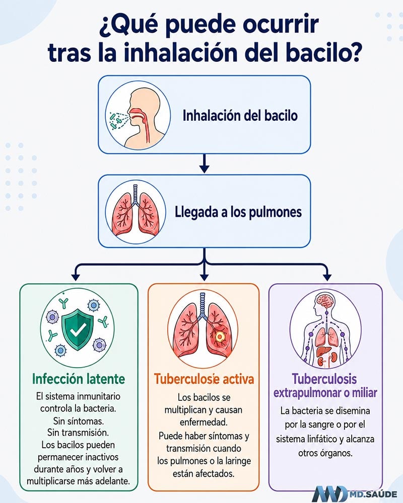 Tuberculosis activa frente a infección tuberculosa latente