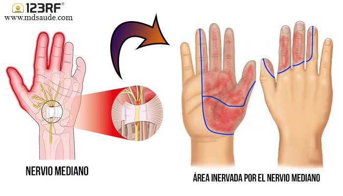 Nervio mediano