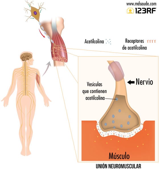 Unión neuromuscular - miastenia