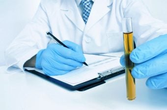 EXAME UROCULTURA – Pra que serve e como colher