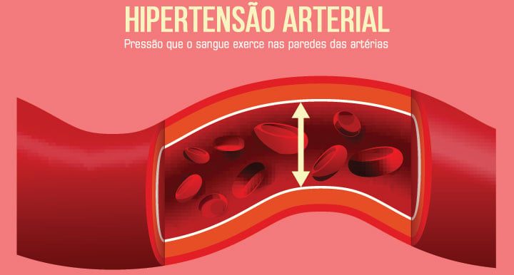 Pressão arterial: pressão que o volume de sangue exerce nas paredes das artérias