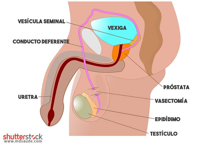 Vasectomía - Anatomía del sistema reproductivo masculino