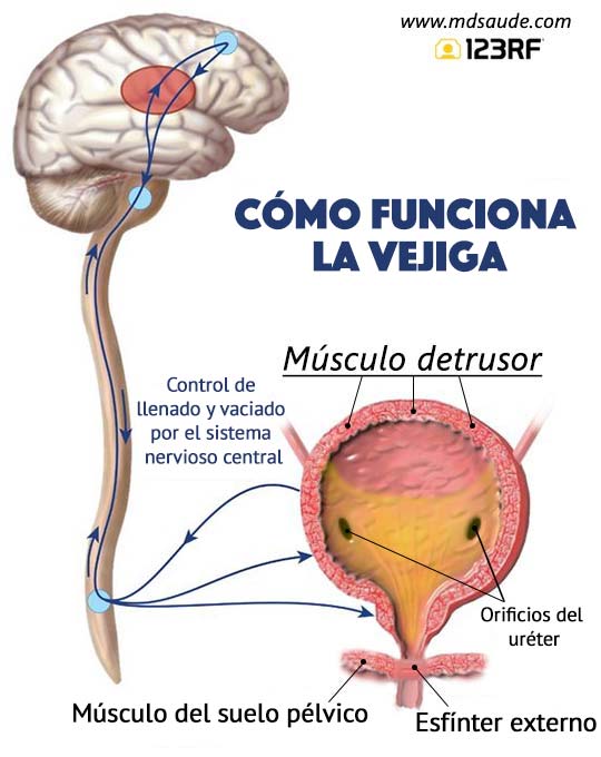 Vejiga hiperactiva