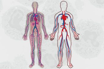 GRANULOMATOSIS DE WEGENER – Causas, síntomas y tratamiento